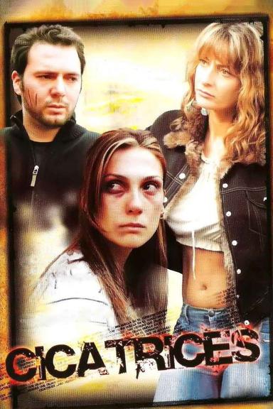Cicatrices